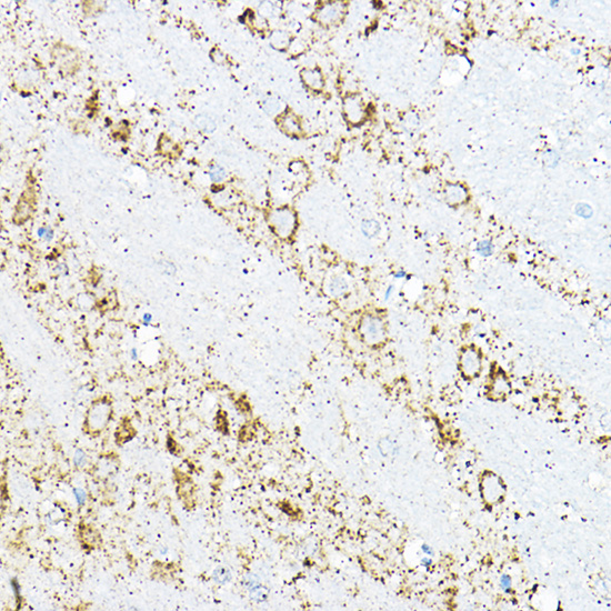 Immunohistochemistry of paraffin-embedded rat brain using BCAT2 Rabbit pAb  at dilution of 1:100 