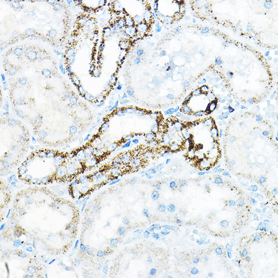 Immunohistochemistry of paraffin-embedded mouse kidney using BCAT2 Rabbit pAb  at dilution of 1:100 