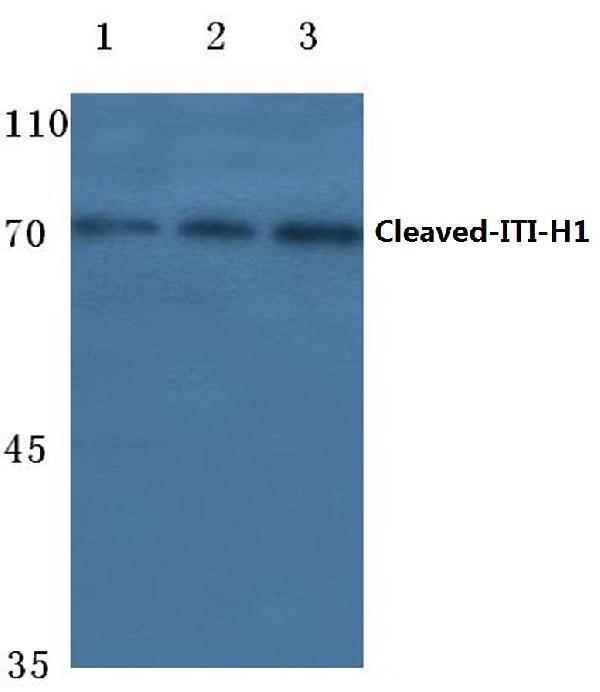 Western blot (WB) analysis of Cleaved-ITI-H1 (D672) polyclonal antibody pAb at 1:500 dilution
Lane1:A549 cell lysate
Lane2:Mouse lung tissue lysate
Lane3:Rat kidney tissue lysate