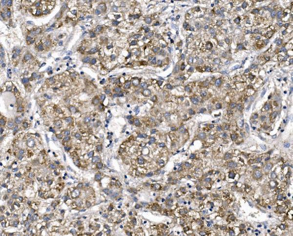 a06375 1 ptch2 primary antibodies ihc testing 2