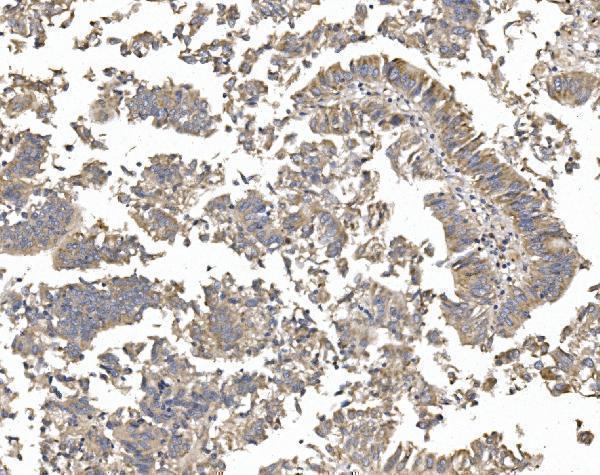 a06375 1 ptch2 primary antibodies ihc testing 3