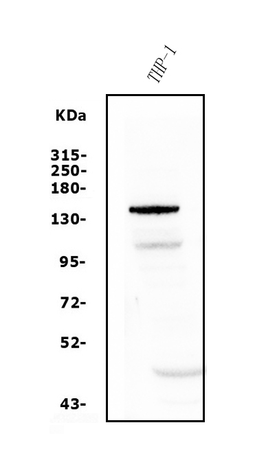 a06375 1 ptch2 primary antibodies wb testing 1