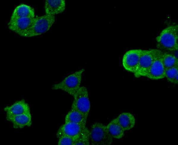 a06377 plxna1 primary antiboties icc testing 1