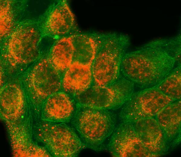 a06381 1 sap18 primary antibodies if testing 2