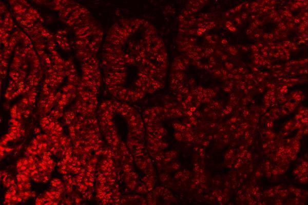 a06381 1 sap18 primary antibodies if testing 4