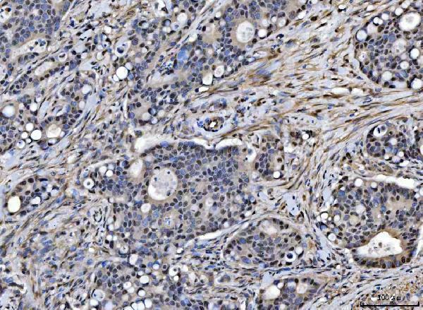 a06381 1 sap18 primary antibodies ihc testing 5