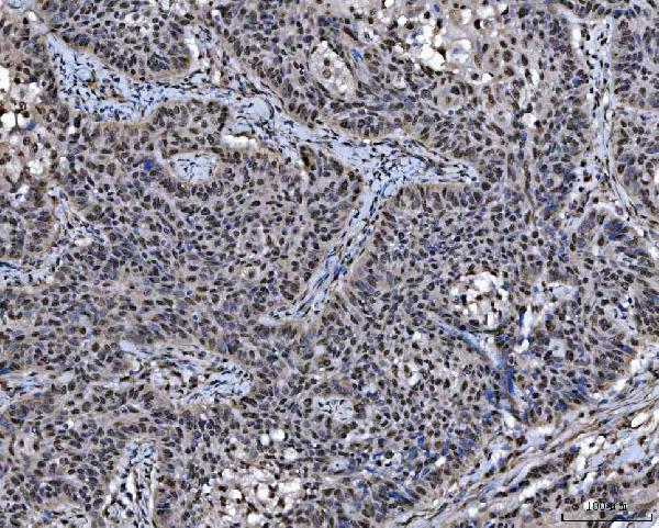 a06381 1 sap18 primary antibodies ihc testing 6