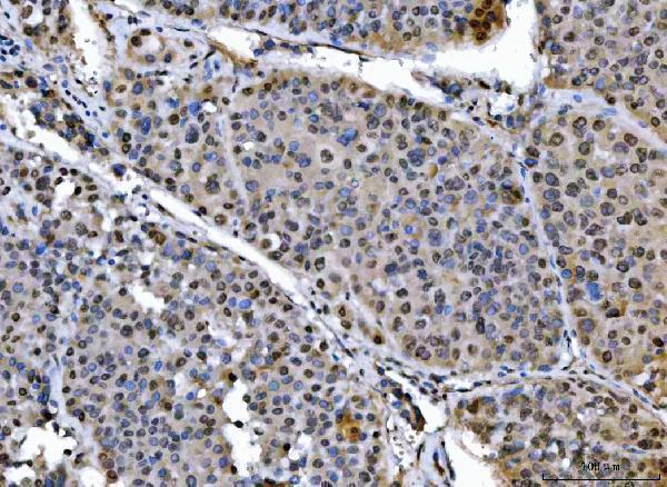 a06381 1 sap18 primary antibodies ihc testing 7