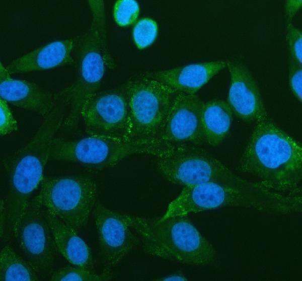 IF analysis of PEX16 using anti-PEX16 antibody (A06382-1)