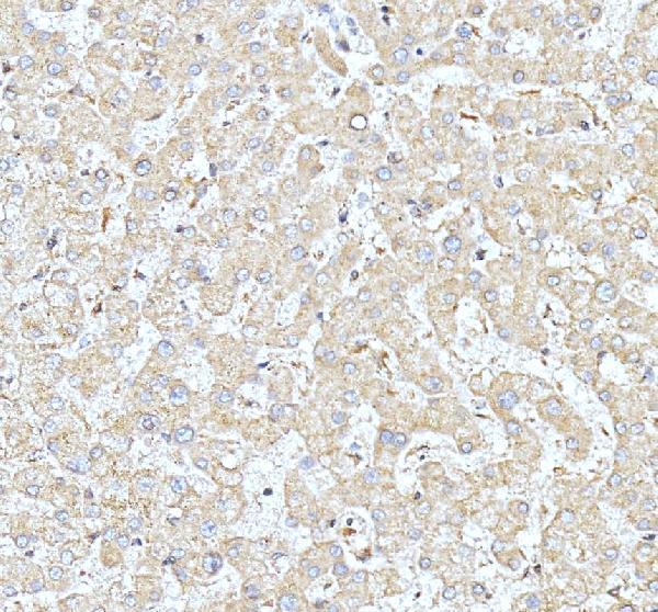 IHC analysis of VPS16 using anti-VPS16 antibody (A06384-2)