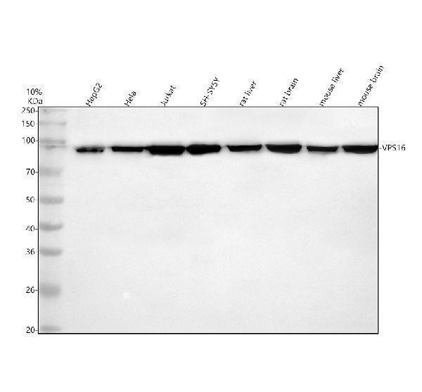  Western blot analysis of VPS16 using anti-VPS16 antibody (A06384-2)