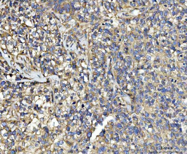  IHC analysis of UBA5 using anti-UBA5 antibody (A06385-2)