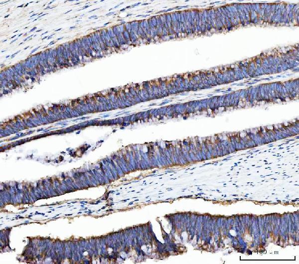  IHC analysis of UBA5 using anti-UBA5 antibody (A06385-2)