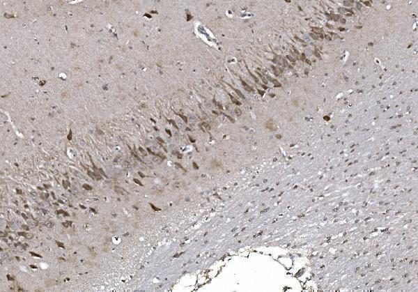a06387 1 cisd2 primary antibodies ihc testing 3