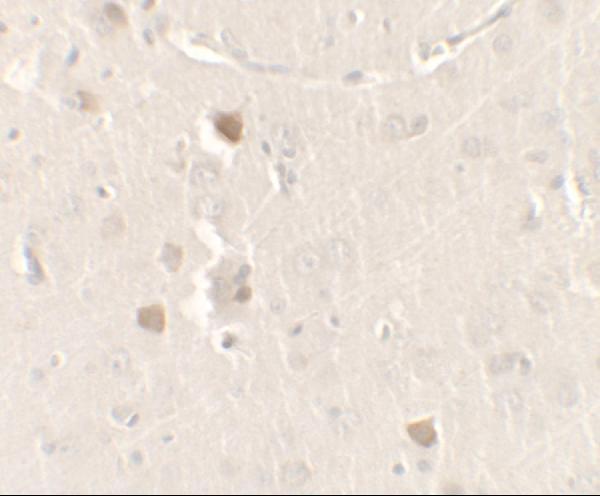 a06387 cisd2 primary antibodies ihc testing 2