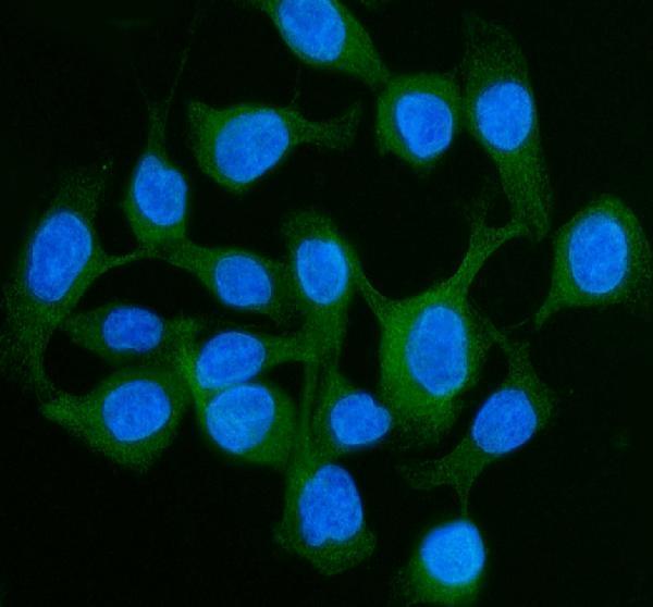 a06389 1 cdh17 primary antibodies if testing 4
