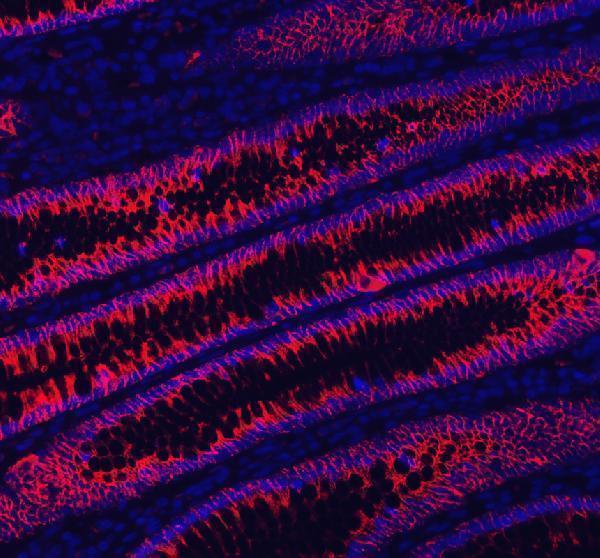 a06389 1 cdh17 primary antibodies if testing 5_1