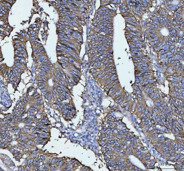 a06389 1 cdh17 primary antibodies ihc testing 1_1