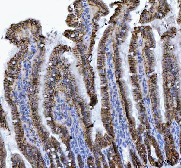 a06389 1 cdh17 primary antibodies ihc testing 2_1