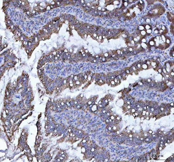 a06389 1 cdh17 primary antibodies ihc testing 3_1