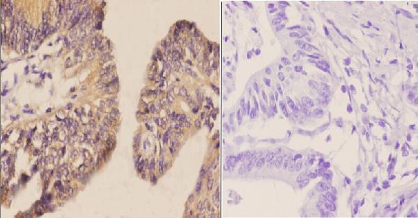 a06389t363 cdh17 primary antiboties ihc testing 2