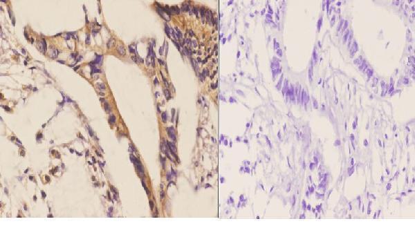 a06389t363 cdh17 primary antiboties ihc testing 3