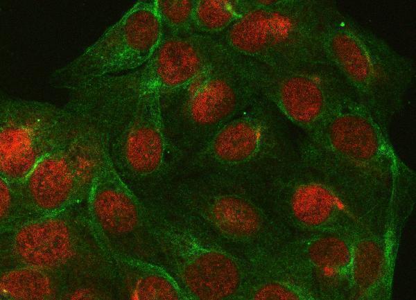 a06390 4 ppp4c primary antibodies if testing 7
