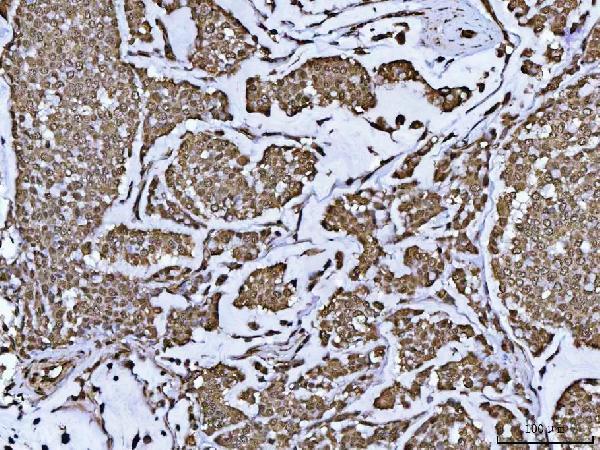  IHC analysis of PPP4C using anti-PPP4C antibody (A06390-4)