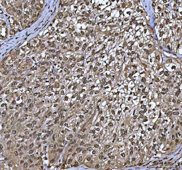  IHC analysis of PPP4C using anti-PPP4C antibody (A06390-4)