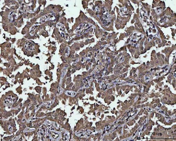 a06390 4 ppp4c primary antibodies ihc testing 4