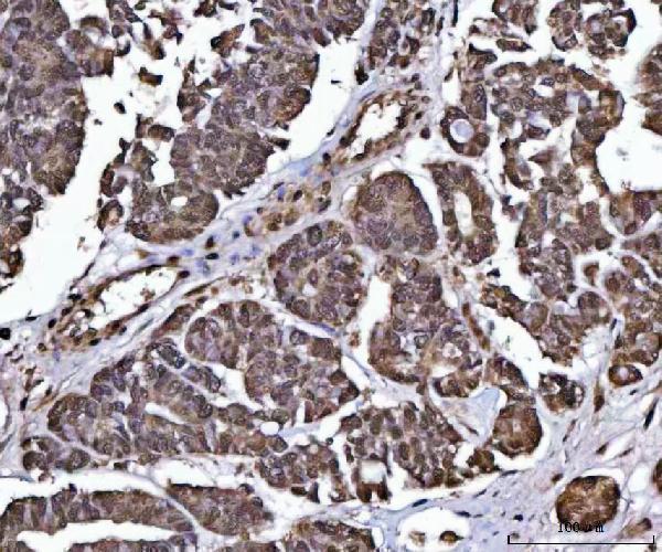 a06390 4 ppp4c primary antibodies ihc testing 5