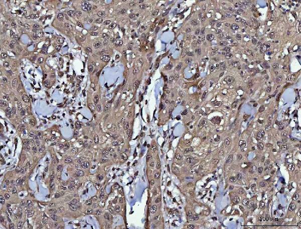 a06390 4 ppp4c primary antibodies ihc testing 6