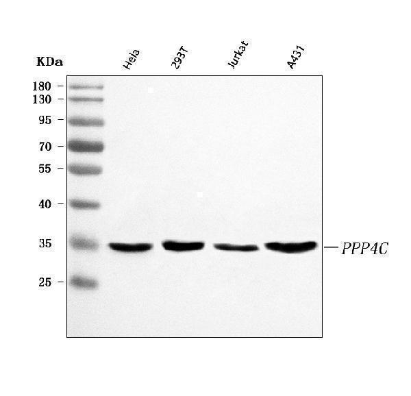  Western blot analysis of PPP4C using anti-PPP4C antibody (A06390-4)