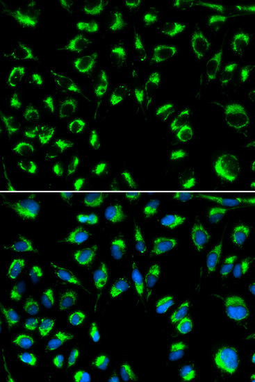Immunohistochemistry of paraffin-embedded human lung cancer using PPP4C antibody  at dilution of 1:100 