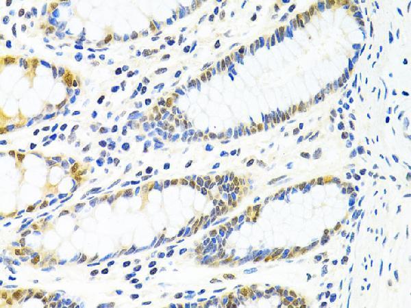 a06390 ppp4c primary antiboties ihc testing 4