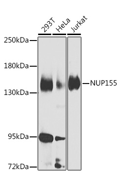 a06391 1 nup155 primary antiboties wb testing 1