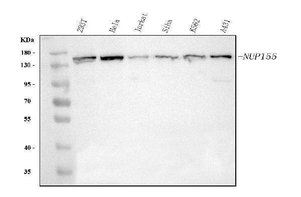  Western blot analysis of NUP155 using anti-NUP155 antibody (A06391-2)