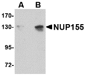 a06391 nup155 primary antibodies wb testing 1