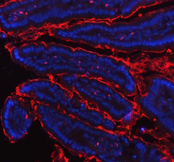 a06392 1 mep1b primary antibodies if testing 4
