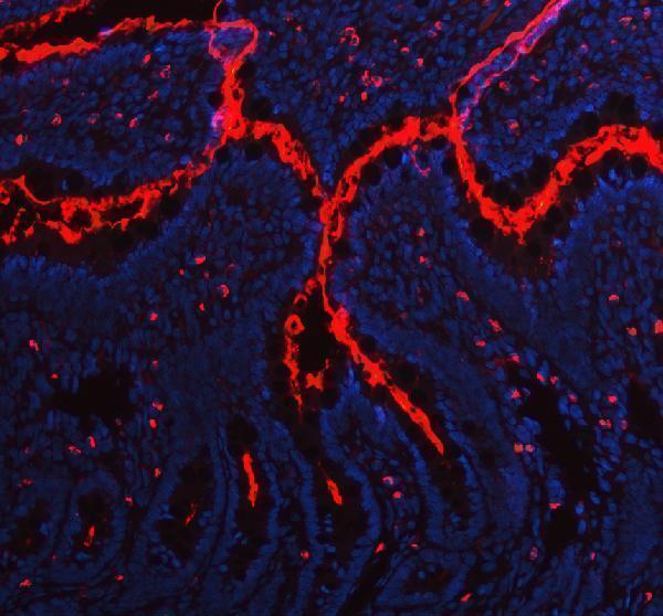 a06392 1 mep1b primary antibodies if testing 5