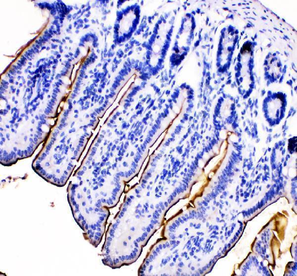 a06392 1 mep1b primary antibodies ihc testing 2_1