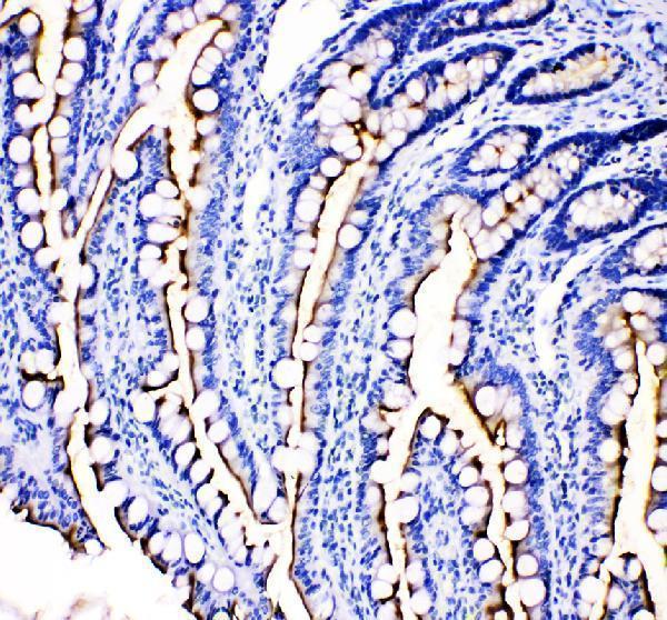 a06392 1 mep1b primary antibodies ihc testing 3_1