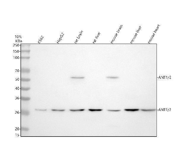  Western blot analysis of ANT1/2 using anti-ANT1/2 antibody (A06393-1)