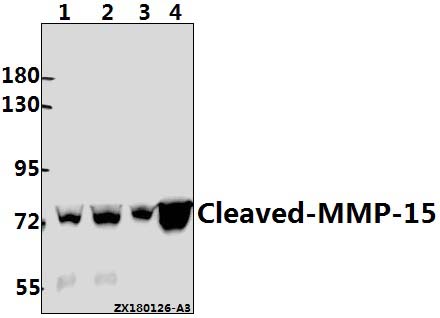 Western blot (WB) analysis of Cleaved-MMP-15 (Y132) pAb at 1:500 dilution
Lane1:MCF-7 whole cell lysate(40ug)
Lane2:SGC7901 whole cell lysate(40ug)
Lane3:HCT116 whole cell lysate(40ug)
Lane4:HEK293T whole cell lysate(40ug)