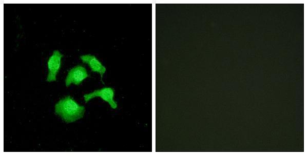 a06397 1 tsc22d1 primary antibodies if testing 1