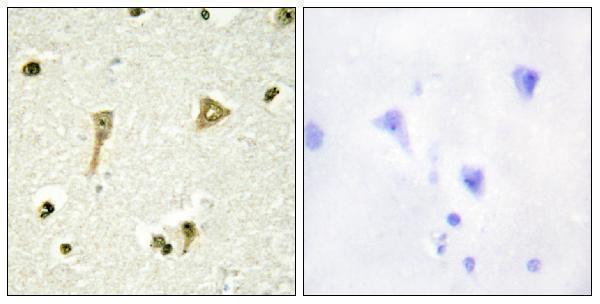 a06397 1 tsc22d1 primary antibodies ihc testing 2