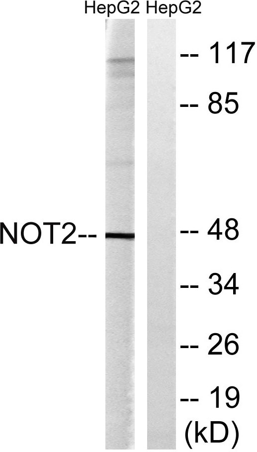 Western blot analysis of lysates from HepG2 cells, treated with starved 24h, using CNOT2 Antibody