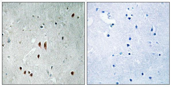 Immunohistochemistry analysis of paraffin-embedded human brain, using CNOT2 (Phospho-Ser101) Antibody