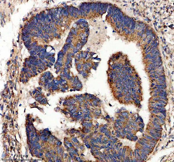 IHC analysis of USP30 using anti-USP30 antibody (A06403-3)