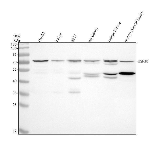 Western blot analysis of USP30 using anti-USP30 antibody (A06403-3)